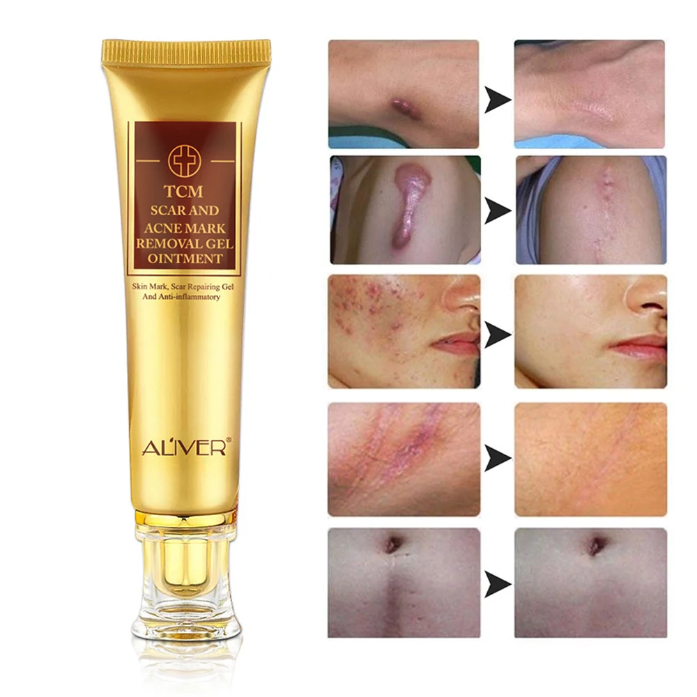 Join. happens. red facial scars share Red facial scars