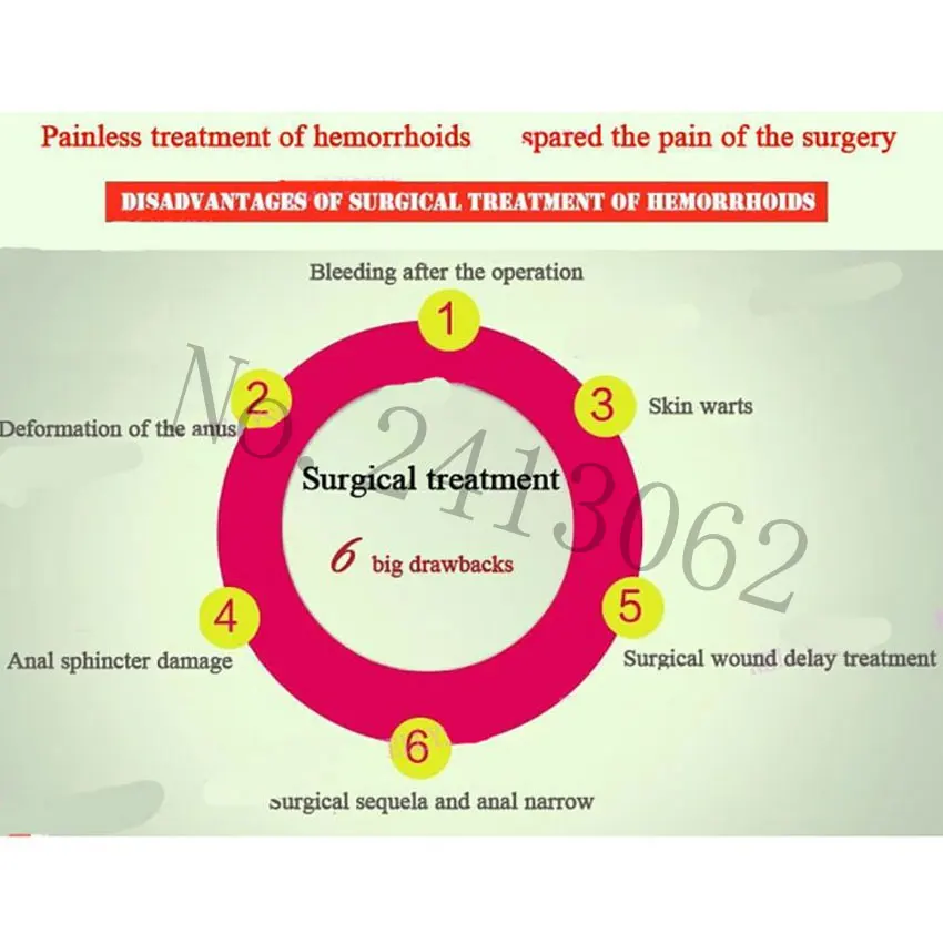 Геморрой, мазь, лечение свечи, внешний геморрой, Анальный раскол ...