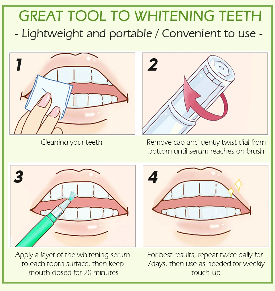 Яркая Гламурная ручка для отбеливания зубов, зубная паста, очищающая сыворотка, удаляет пятна от налета, стоматологический инструмент, гигиена полости рта, зубной гель, отбеливающий