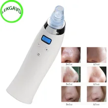 Bestp угорь вакуумных Алмазная Микродермабразия дермабразия устройства