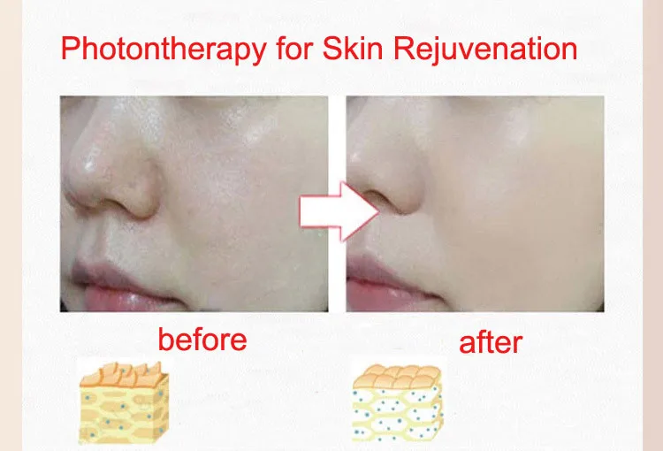 skin rejuventation comparison