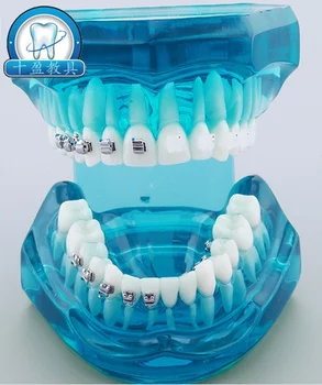 

Dental Orthodontic teaching Model Ceramic Ceramic Metal Tongue Self-locking 4 Bracket Contrast demonstration
