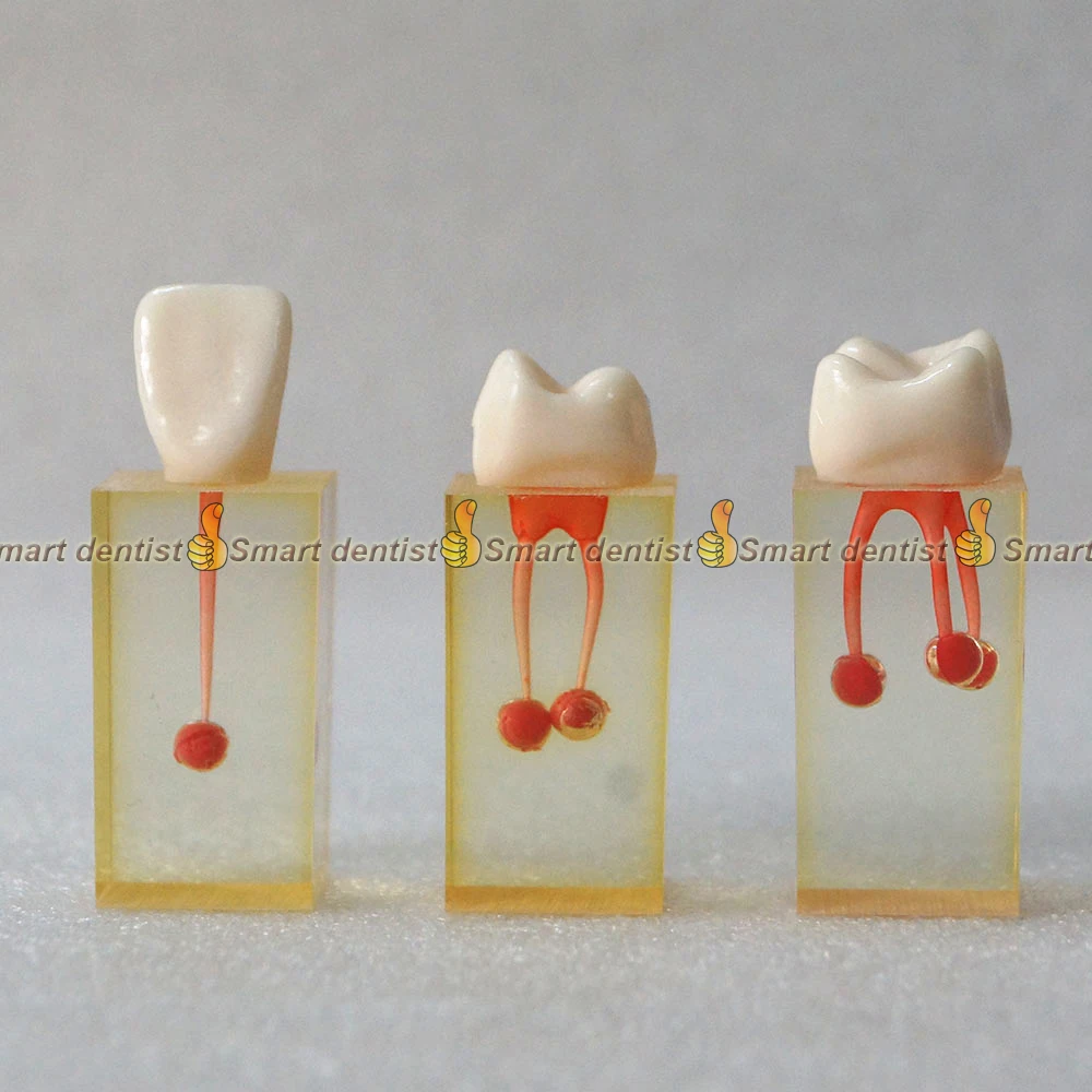 1 Set X Resin Dental Canal Endodontic Student Study Practice Operation