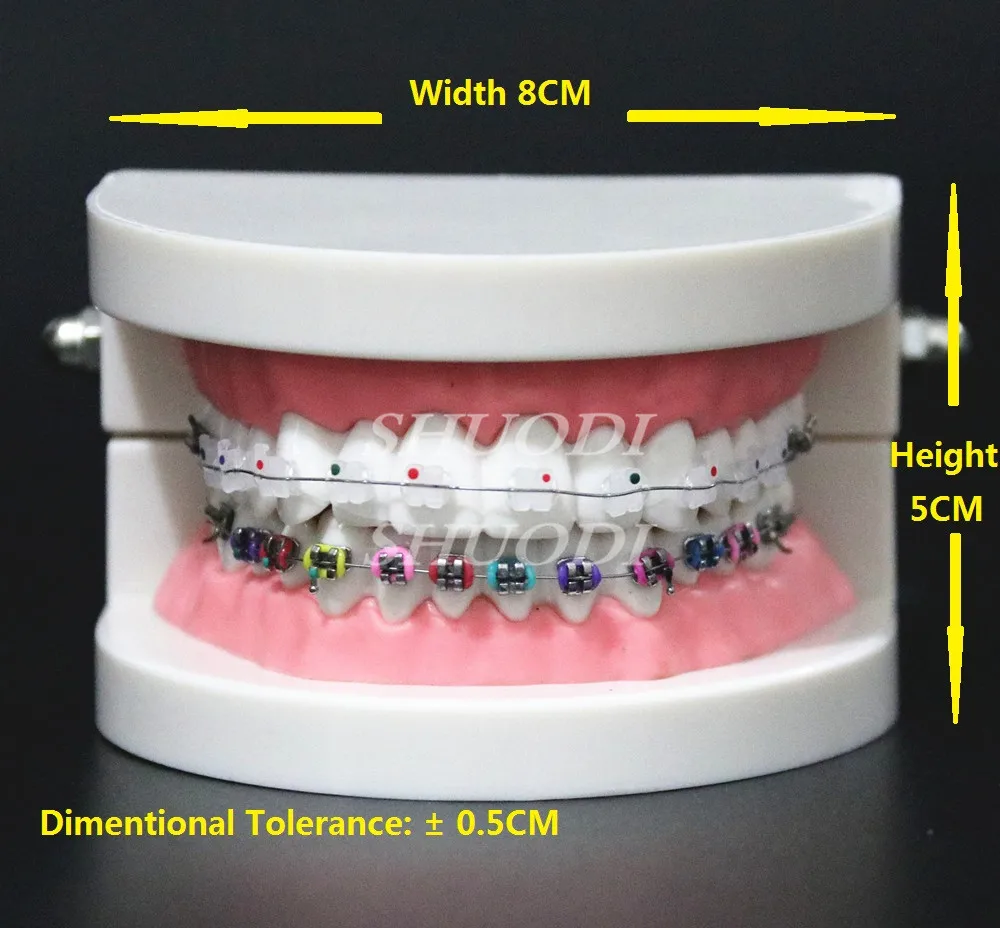 Dental Orthodontic Treatment Model With Ortho Metal Ceramic Bracket Arch Wire Buccal Tube