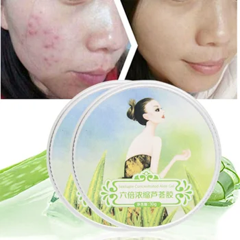

New Aloe Vera Gel Super Hydrating Anti-Inflammatory Remove Pimple Skin Care Remover Pimple Mark Moisturizer Cosmetics