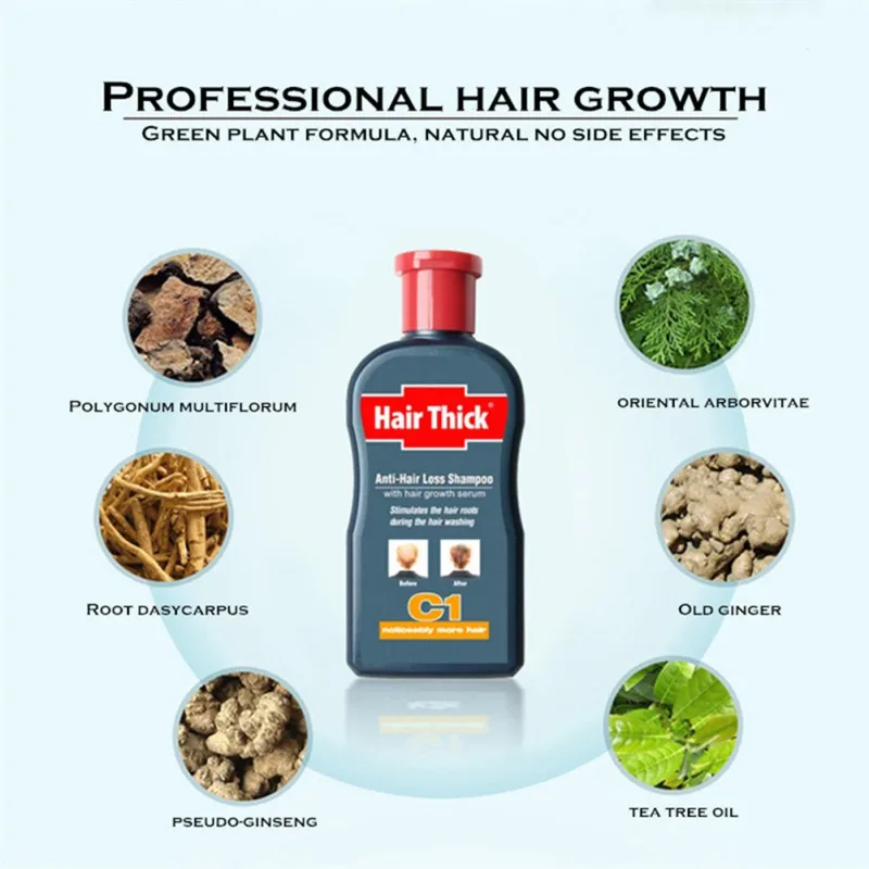 100ml Anti-Hair Loss Shampoos Hair Thicken Treatment Oil Control Anti Dandruff Itch Hair Care 100ml Anti-Hair Loss Shampoos Hair Thicken Treatment Oil Control Anti Dandruff Itch Hair Care