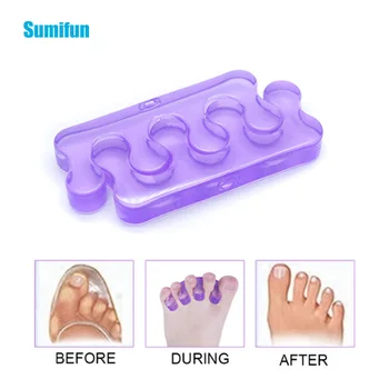

2Pcs Sumifun Slicone Toe Separator,Stretcher For Men And Women ,allux Valgus ,Straighter Professional Feet Care massage C1416
