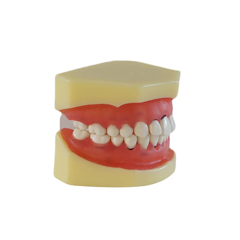 Dental Materials Lab Peridontal Disease Model