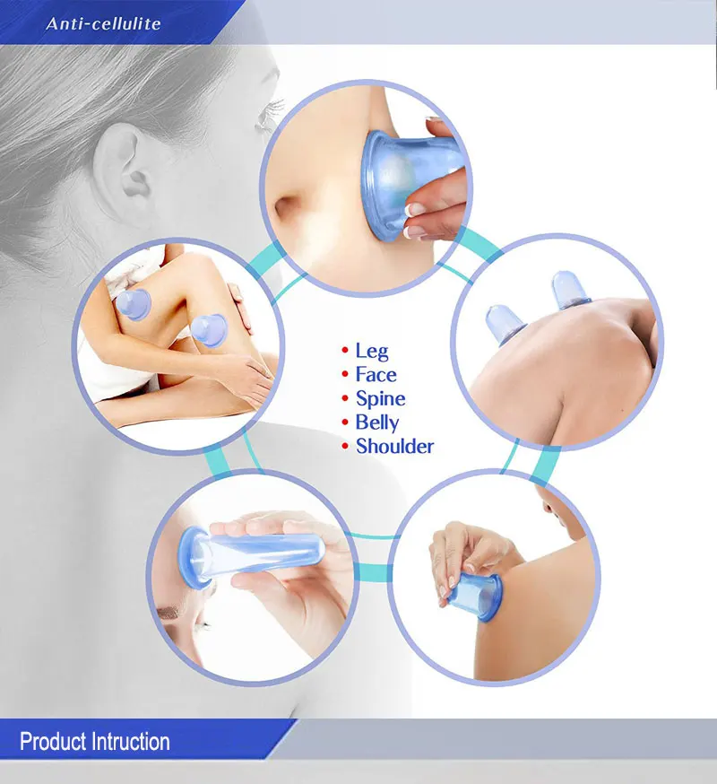 cupping (2)