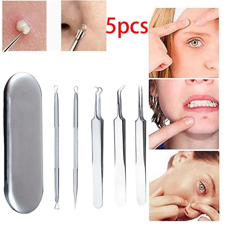 

5 Pcs Stainless Steel Acne Extractor Set Double Ended Pimple Blemish Blackhead Acne Needle Extractor Tweezers Remover Set