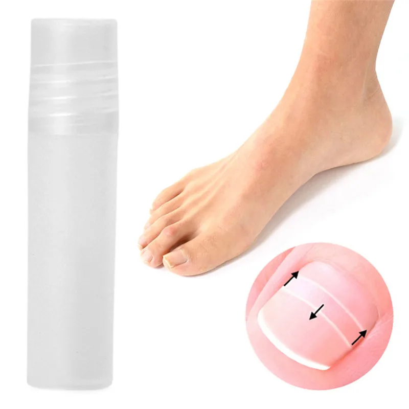 10 шт. зажимы для выпрямления вросших ногтей|ingrown toenails|nail toolstoenail ingrown |