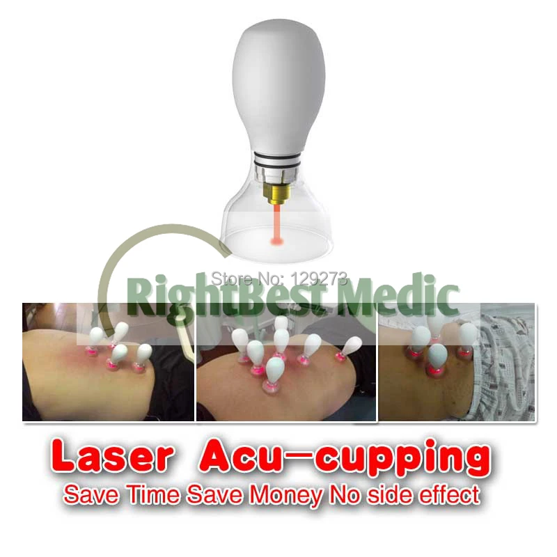 Laser Acu-cupping for Slimming, POPULAR slimming machine, 3 in 1, laser acupuncture+cupping+magneto therapy Laser Acu-cupping for Slimming, POPULAR slimming machine, 3 in 1, laser acupuncture+cupping+magneto therapy