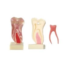 6 раз анатомическая модель профиля мэндибулярной молярной формы для зубной ступени и образования