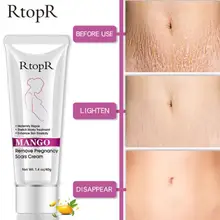 RtopR материнский шрам ремонт крем для тела средство для удаления растяжек манго шрамы после беременности удаление крем против старения против морщин укрепляющий