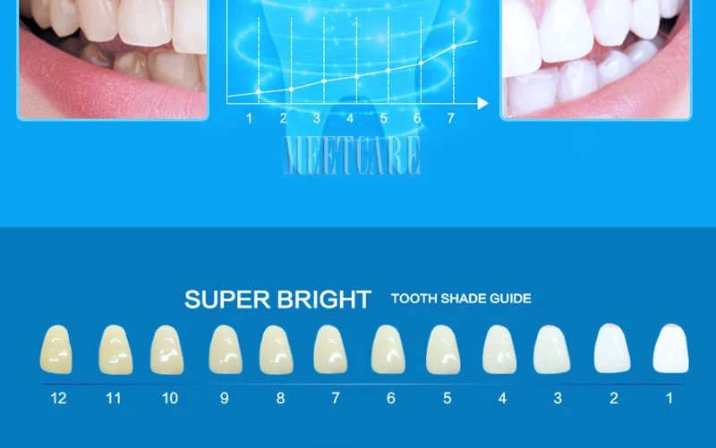 Устройство для отбеливания зубов набор гель для полости рта съемный дезинфекция отбеливание зубов определённое время холодного света отбеливание зубов зарядка через usb
