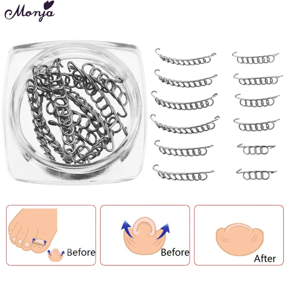 

12pcs Nail Art Ingrown Toe Nail Correction Patch Corrector Recover Care Paronychia File Foot Pedicure Care Tool