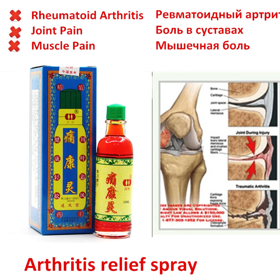 Китайский травяной шаолиньский обезболивающий крем Подходит Для ревматоидного артрита боли в суставах боли в спине облегчение боли колена Обезболивающий бальзам мазь