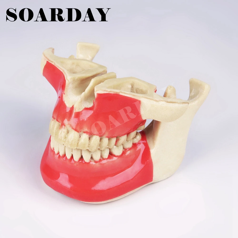 Buy Implant Dental Practice model Foam plastic