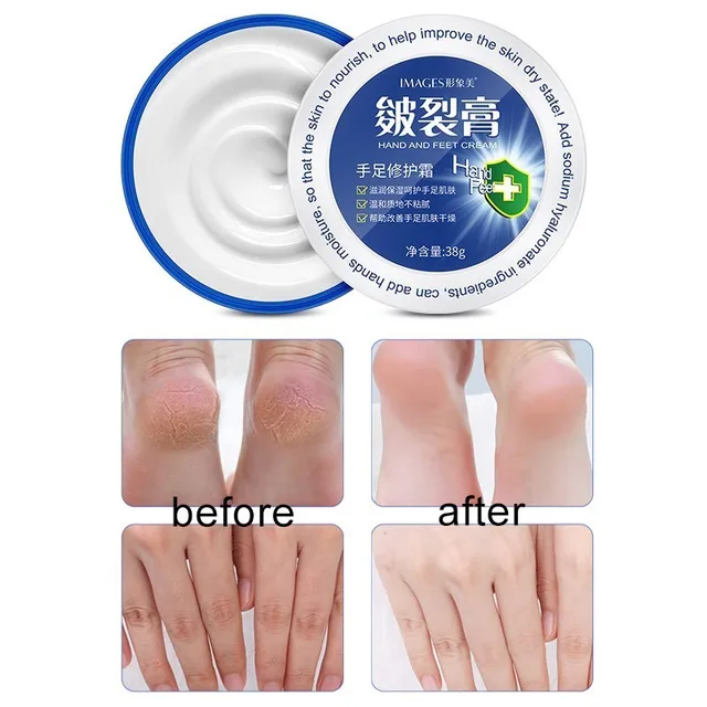 Moisturizing Hand And Feet Cream Anti Wrinkle Anti Aging, Whitening, Nourishing, Anti Chapping 