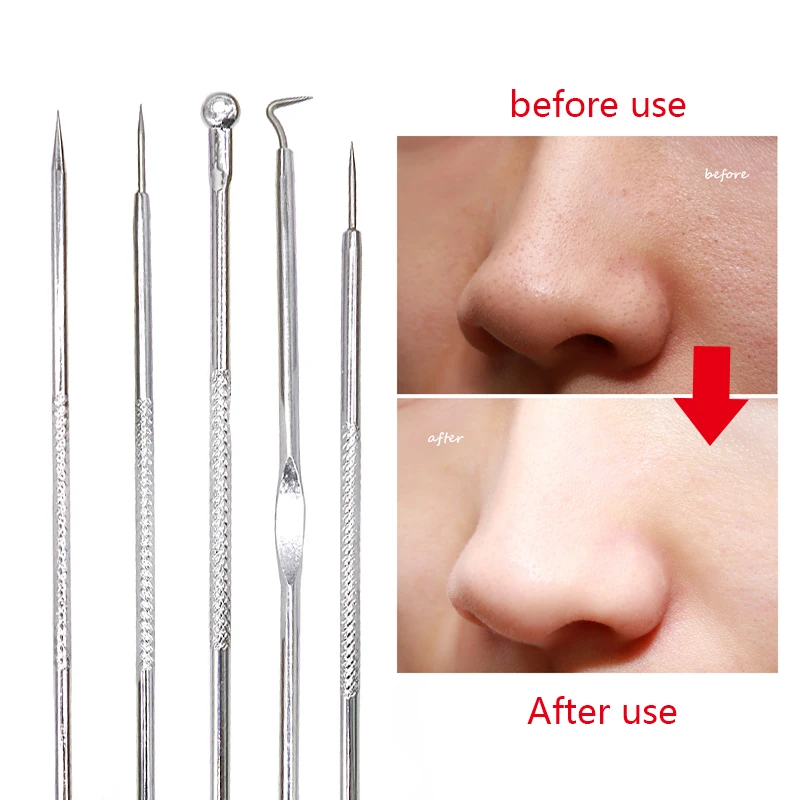 

1Set Acne Extractor Pimple Remover Tool Black Head Point Noir Cleaner Acne Needle Face Blackhead Remover Comedone Extractor Kit