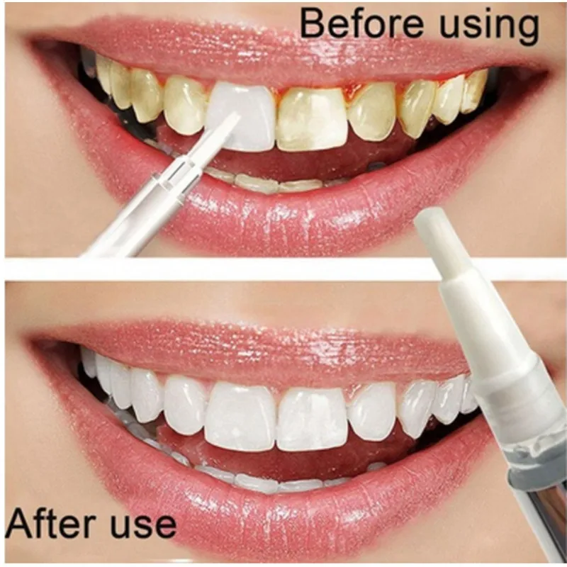 RORASA 1pc Popular White Teeth Whitening Pen Tooth Gel ...