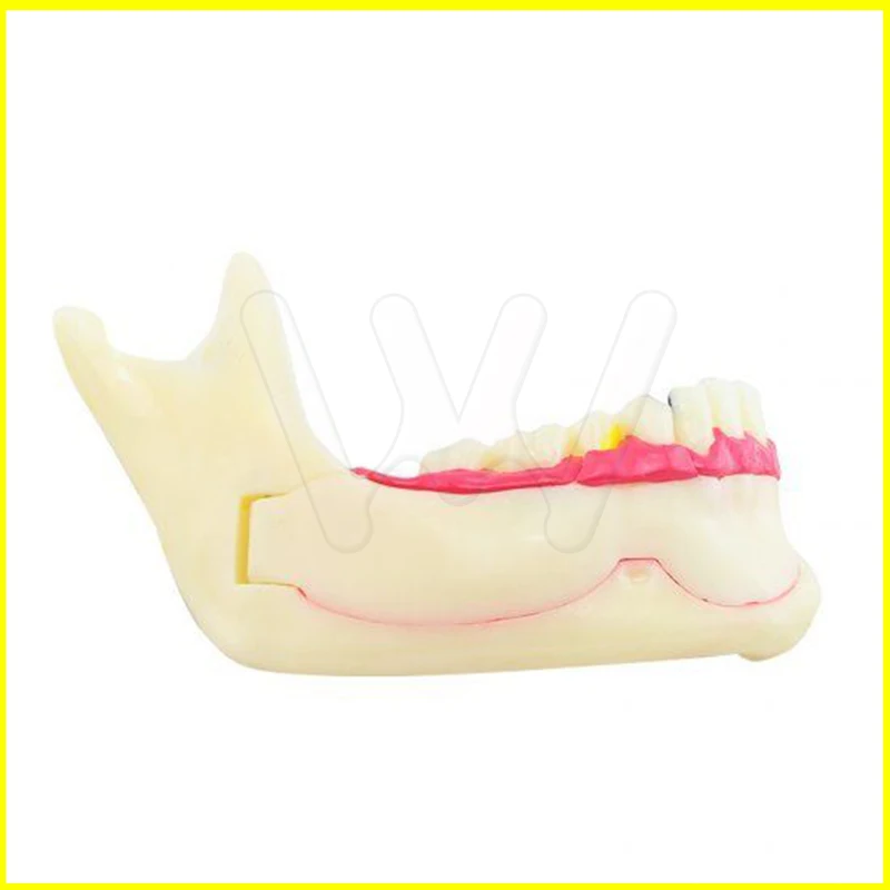 Dental MandibularTeeth Demonstration Anatomical Patient Study Teach Model (3)