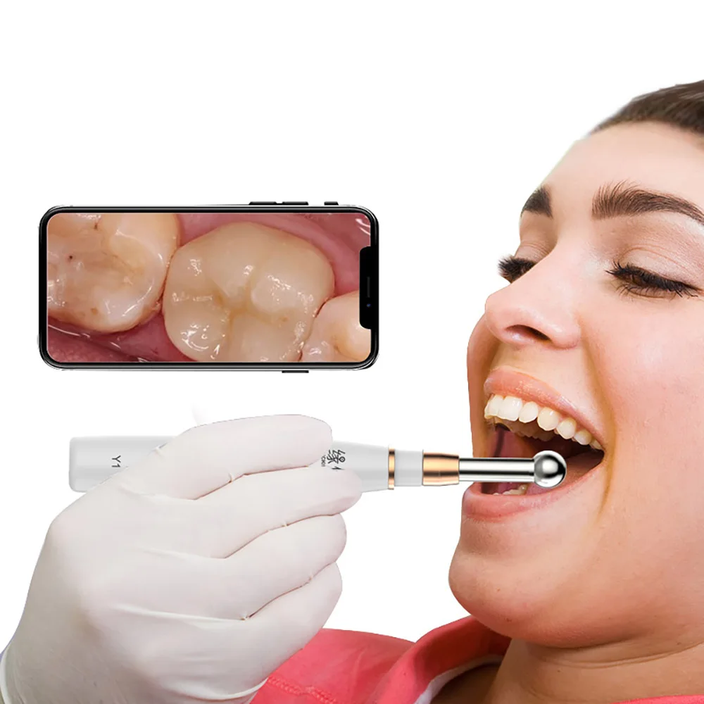 Dental Intraoral Check Digital Micro Camera Professional USB Micro check Camera Oral Dental