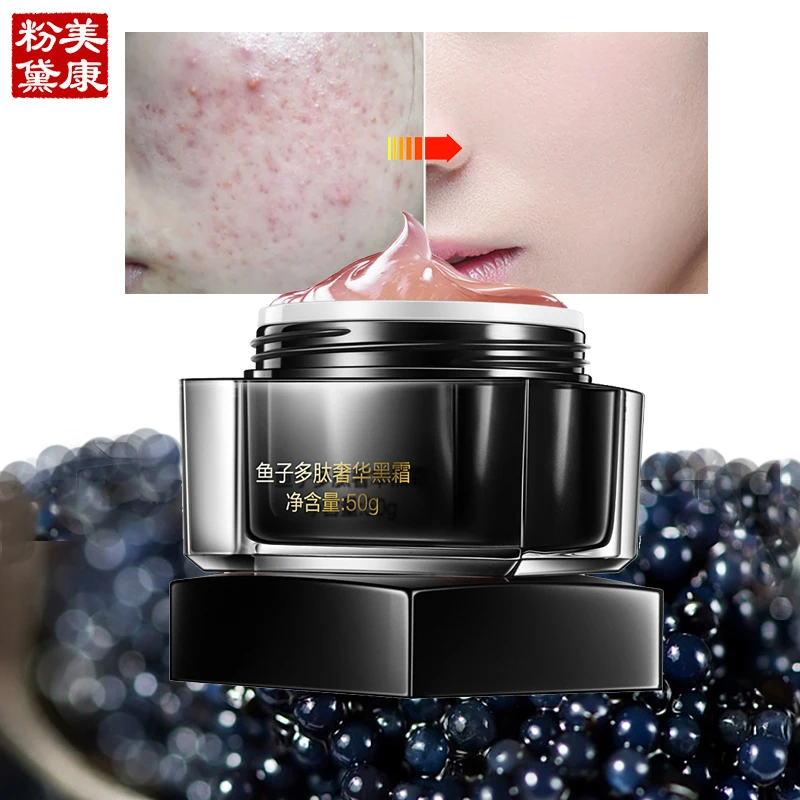 

MEIKING Caviar Luxe Black Face Cream Skin Care Anti-Aging Acne Treatment Moisturizing Whitening Free Shipping 2017 New Face Care