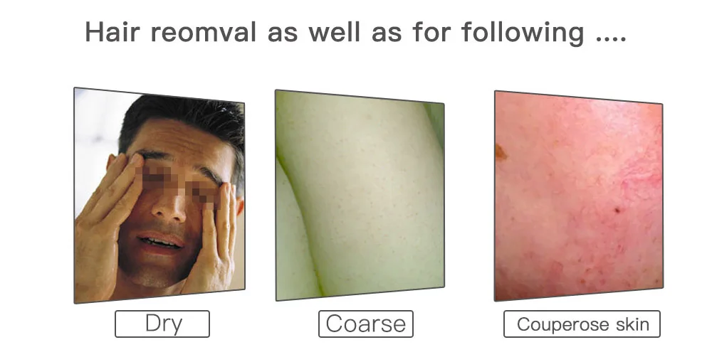 Da Pele rejuvenescimento da Pele