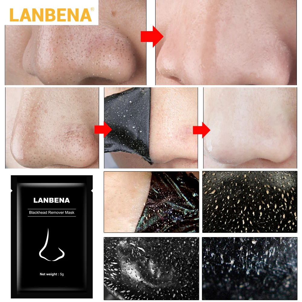 LANBENA T Zone средство для удаления черных точек на носу черная маска лица глубокое