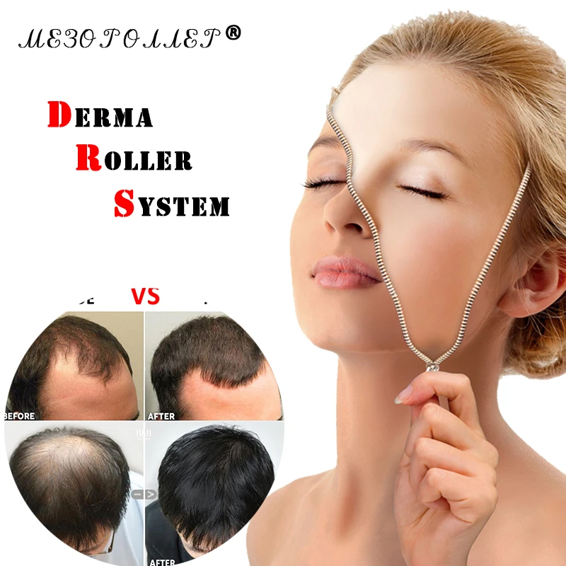 

Microniddle rollers for Faces and mezoroller with needles Hair Regrowth Treatment Thinns Hair/Bald /micros needler rollers Fores