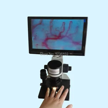 

Color screen Nail Fold Capillary microcirculation test machine