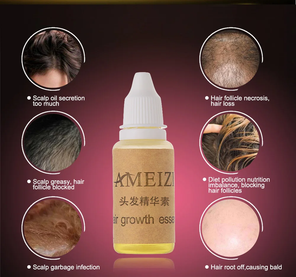 Ameizii быстрое средство для роста волос от выпадения волос продукты густые волосы быстрый рост Выжженных волос масла Уход продукт 20 мл