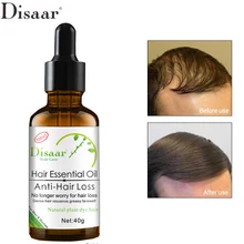 Disaar быстрые мощные средства с эссенцией для рост волос эфирное масло лечение Предотвращение выпадения волос уход за волосами Andrea 30 мл