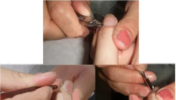 Кутикулы Щипцы Nail Art Инструмент Золинген ножницы омертвевшей кожи пилинг плоскогубцы триединой ногтей маникюрные инструменты