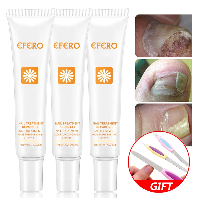 EFERO Nail Fungus Cream Foot Fungal Nail Treatment for Cuticle Remover