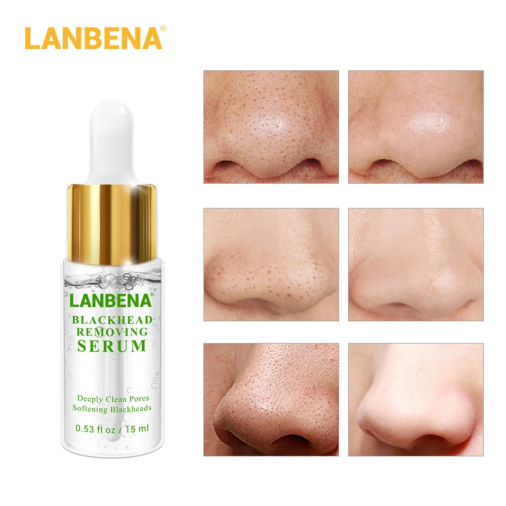 

LANBENA 20ML Deep Blackhead Softener Blackhead Derived Liquid Nose Black Head Remover Acne Treatment Deep Cleansing Skin Care