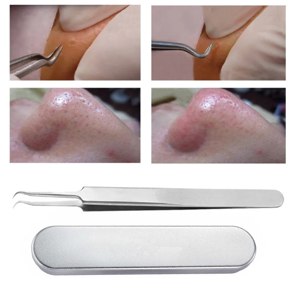 

ELECOOL 1PC Bend Curved Acne Clip New Stainless Steel Tweezer Clips Pimple Comedone Skin Care Face Cleaner Blackhead Remover