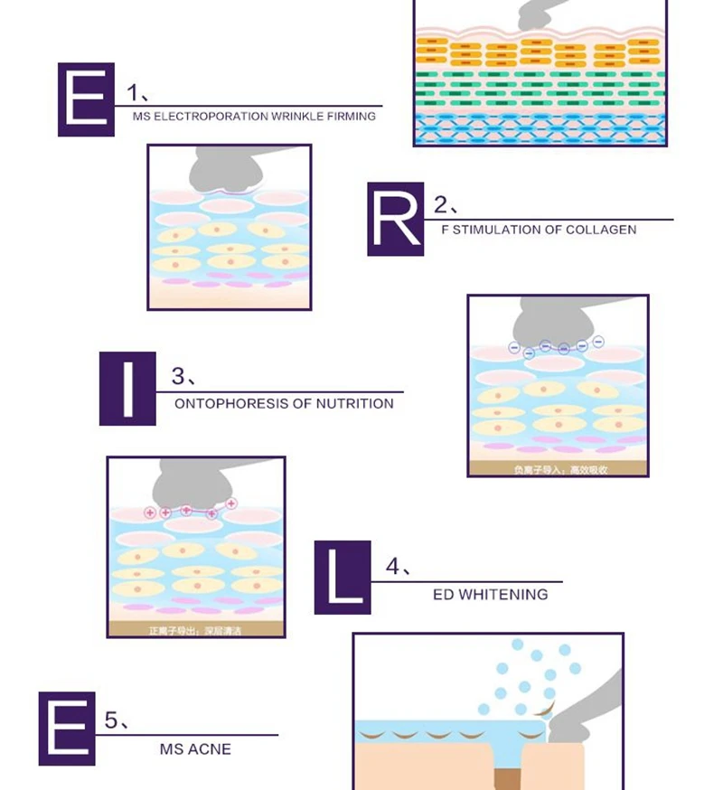 4 в 1 РЧ+ EMS+ светодиодный светодиодная маска для лица+ термажная мезопорация машина радио частота Мезотерапия Электропорации устройство уход за кожей
