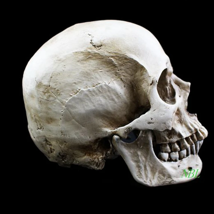 культура паракас черепа. деформированный человеческий череп. трепанация черепа паракас. черепа паракаса elongated skulls. большой череп головы.