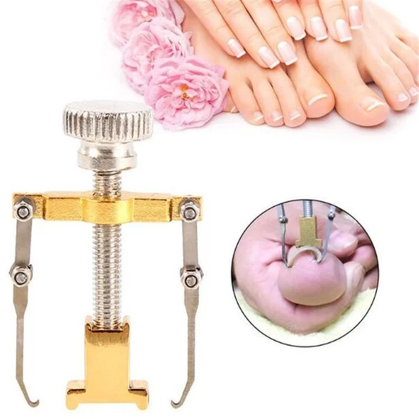 

1PC Ingrown Toe Nail Recover Correction Tool Pedicure Toenail Fixer Foot Nail Care Tool Orthotic Nail Corrector Pedicure Tool
