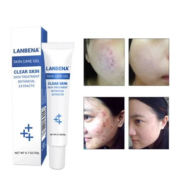

LANBENA Acne Scar Remove SKin Care Acne Treatment Shrink Pores Gel Bleaching Creams Whitening Moisturizing Face Cream 20g
