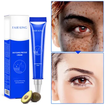 

20g Freckle Removal Cream Dark Spot Skin Pigmentation Age Spots Skin Whitening Cream SK88