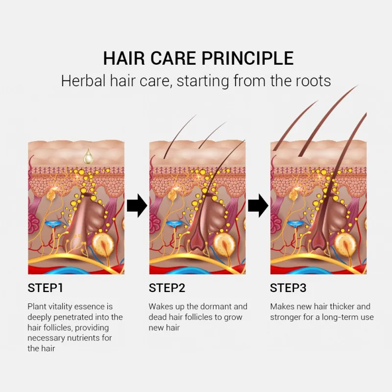 Роста волос, эфирные масла быстро Мощный волос товары Питательный Уход за волосами предотвратить облысение против выпадения волос