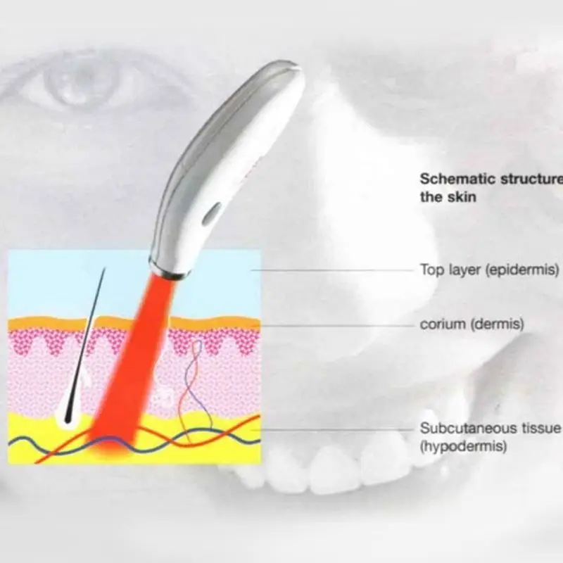

2018 new Acne Pen Soft Laser Scar Wrinkle Blemish Removal Light LLLT Treatment Skin Face