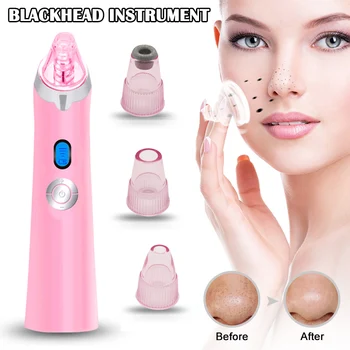 

Blackhead Remover Pore Vacuum Cleaner Electric Facial Pore Cleaner USB Rechargeable Female Male NShopping