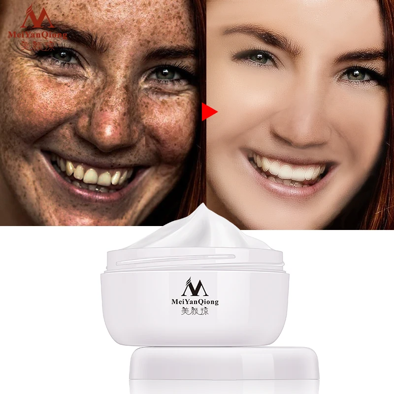 Powerful Whitening Freckle Cream 40g Remove Melasma Acne Spots Pigment