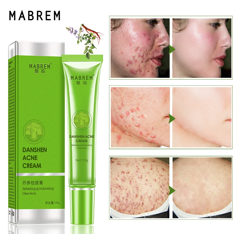 

MABREM Salvia Acne Treatment Cream Removal Face Blackhead Anti Acne Cream Oil Control Shrink Pores Acne Scar Face Care Whitening