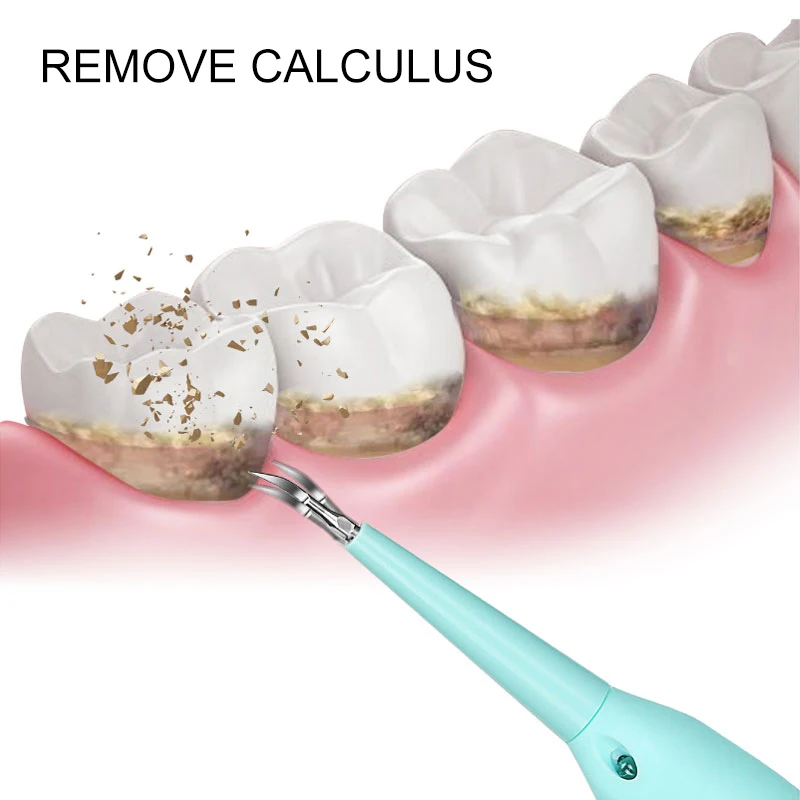 

Third Generation Electric Sonic Dental Scaler Tooth Calculus Remover Tooth Stains Tartar Tool Teeth Whitening Oral Care Kits