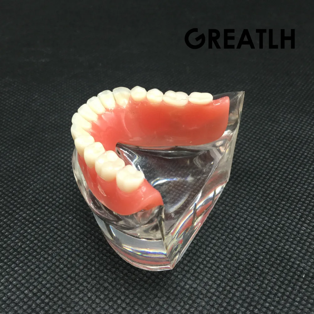 Зубные Overdenture Зубы Модель съемный интерьер нижние челюсти модель нижние челюсти с имплантатом для зуб обучения, изучения